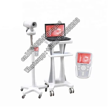 LH9800A Горячая продажа Цифровая Электронная Видео кольпоскопия для гинекологии/Портативный гинекологический аппарат для женщин